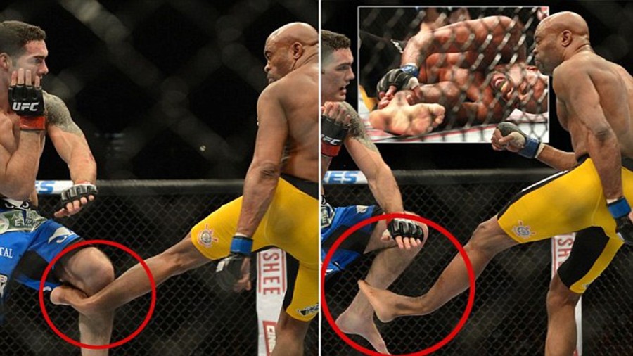 Krvavi prizori: 10 najgorih ozljeda u MMA sportu