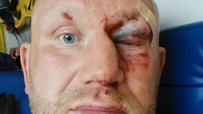 Kharitonov o čovjeku koji ga je pretukao: On je najnečasnija osoba koja postoji