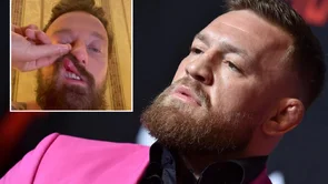 McGregor u novom skandalu: Iz čista mira udario i slomio nos talijanskom DJ-u!
