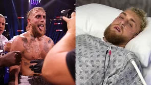 Jake Paul se javio iz bolnice: "Slomio sam leđa... Noseći medijsku promociju za ovu priredbu!"