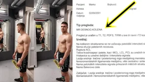 Marko Bojković otkrio detalje teške ozljede: "Potrebna je operacija i dugi oporavak, ali smo se odlučili na još jedan bolestan izazov!"