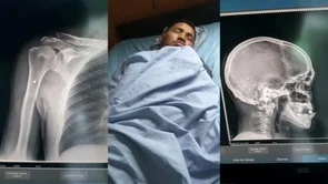 Bivši boksački prvak Ricardo Mayorga završio je u bolnici nakon što je ponovno pretučen na ulici