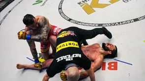 Mamed Khalidov doživio teške frakture lica: Nakon nokauta ugrađena je metalna pločica i slijedi dug oporavak!