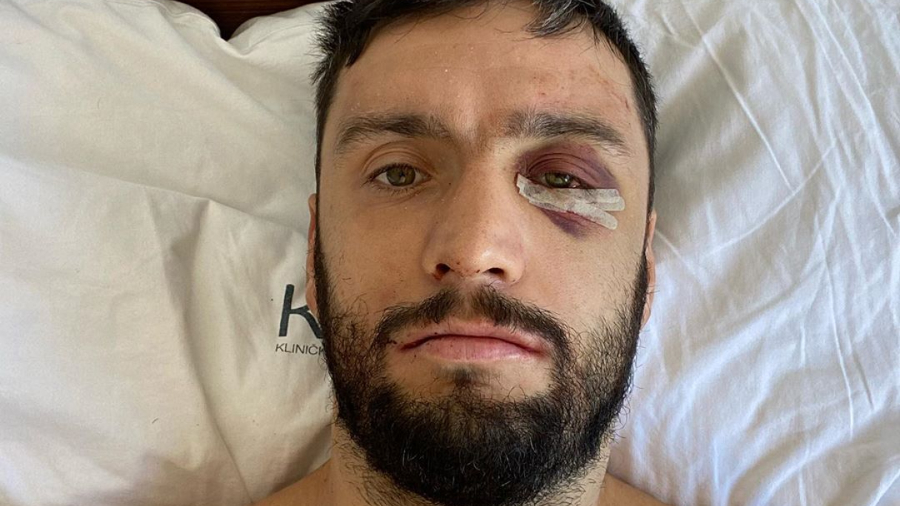 Marko Čalić uspješno odradio operaciju: Sada slijedi oporavak, u ring se vračam bolji i jači 