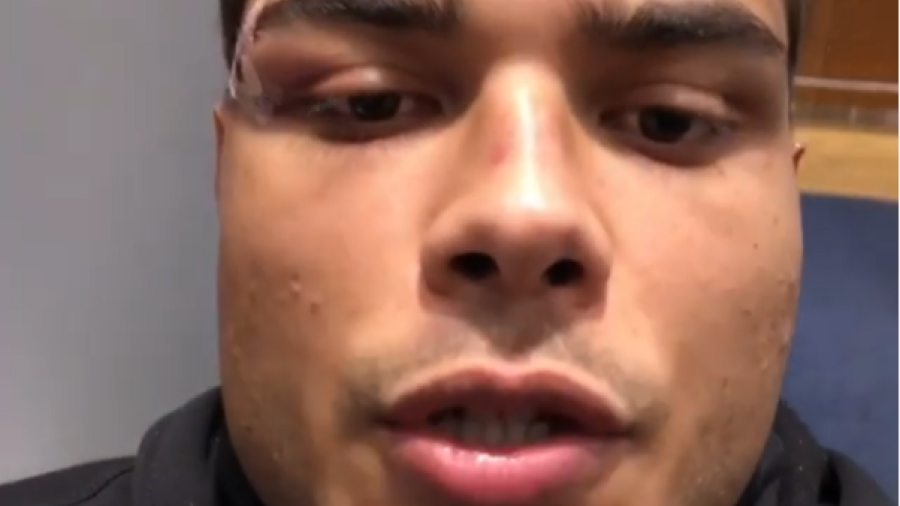 Paulo Costa želi revanš s „ljudskim smećem“ Israelom Adesanyom: Natjerat ću ga da plati