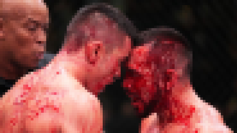 Nestvarno: Pobijedio UFC borbu pa zbog prerezane arterije izgubio 20 posto krvi iz tijela!